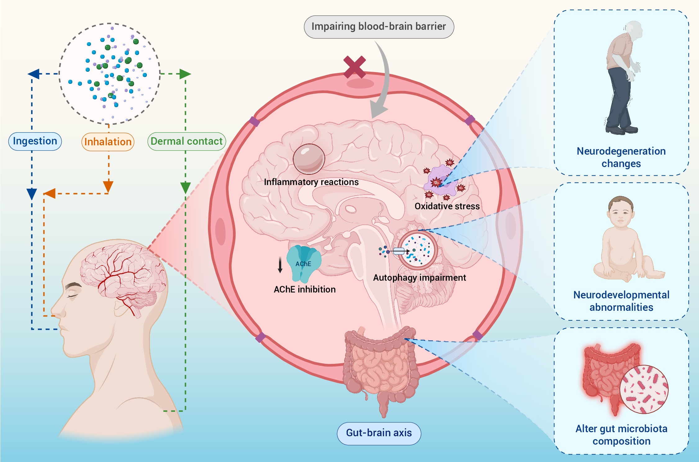 Microplastics and the gut-brain axis: Unraveling neurotoxic mechanisms and  health implications