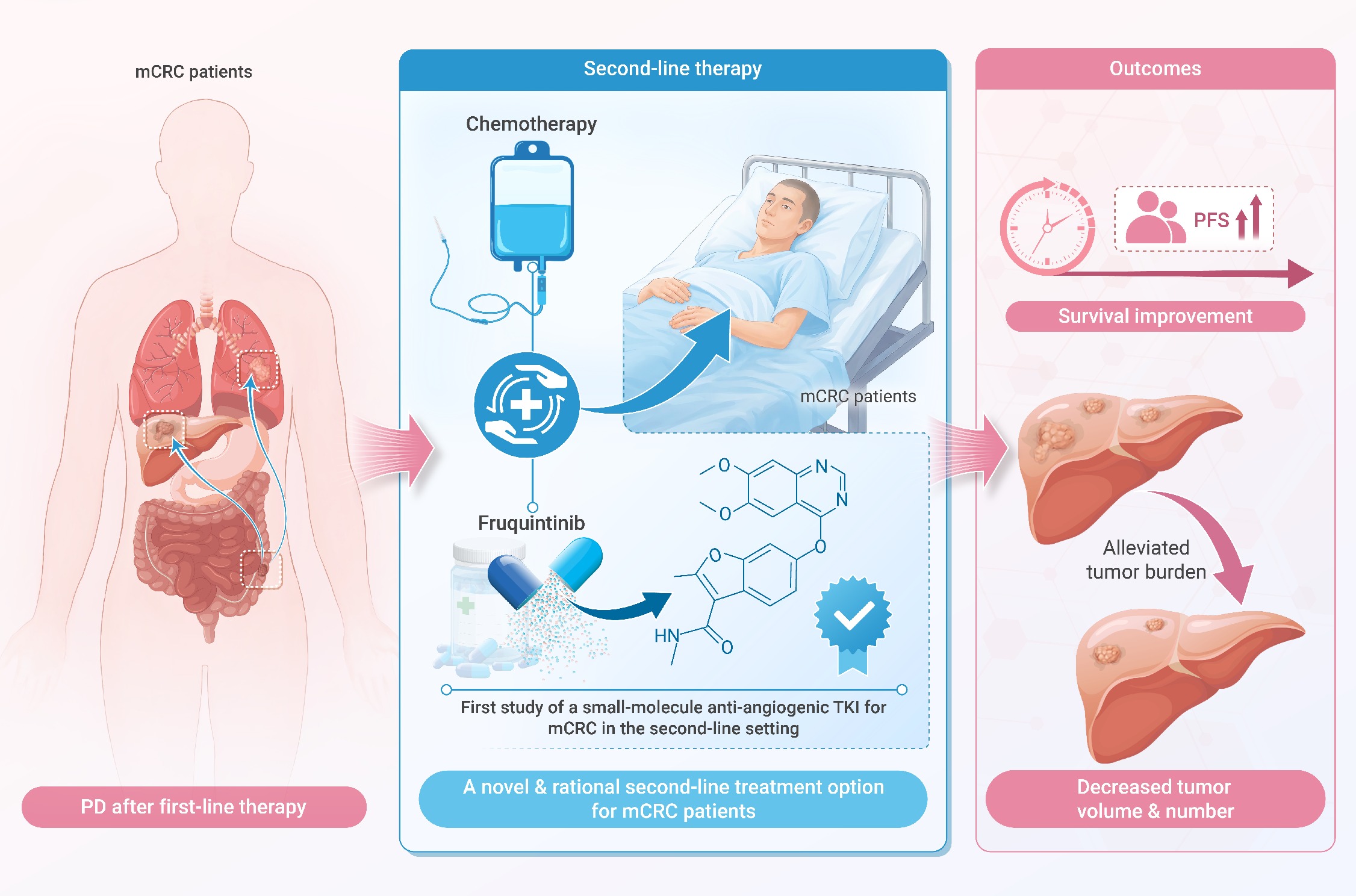 Efficacy and safety of fruquintinib plus chemotherapy as second