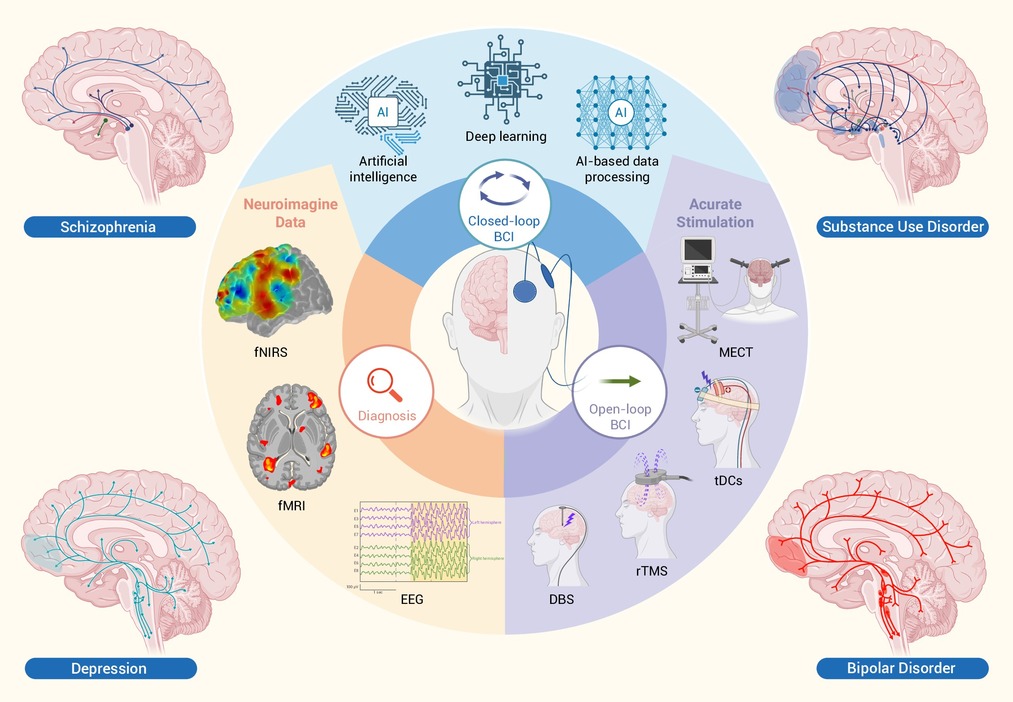 A brain-computer interface roadmap for diagnosing and treating ...